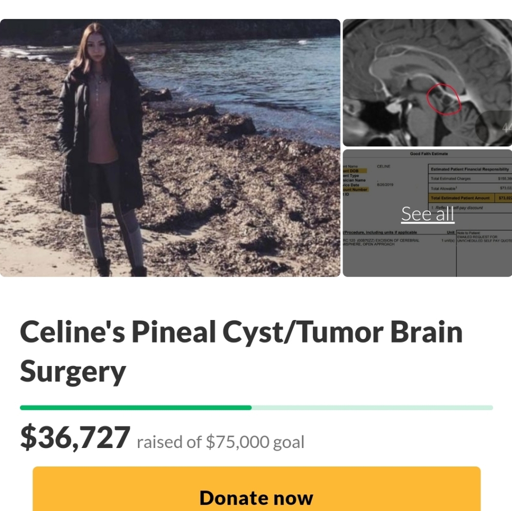 RAISING MONEY FOR BRAIN SURGERY! - Picture 2 of 2